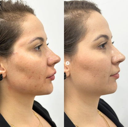 IN OFFERTA: Kit Oro 24k 5 IN 1 con Acido Ialuronico e Bava di Lumaca