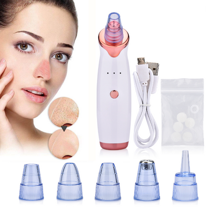 Aspiratore punti neri